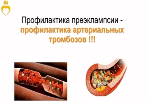 Профилактика